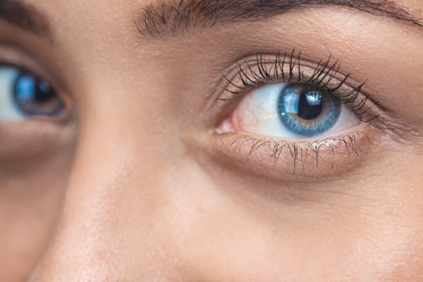 Does Eyelid Surgery Improve Sleep? Link to Eye Comfort Explored