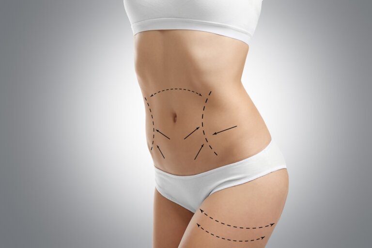 Realistic Expectations from Liposuction: A Guide to Authentic Changes
