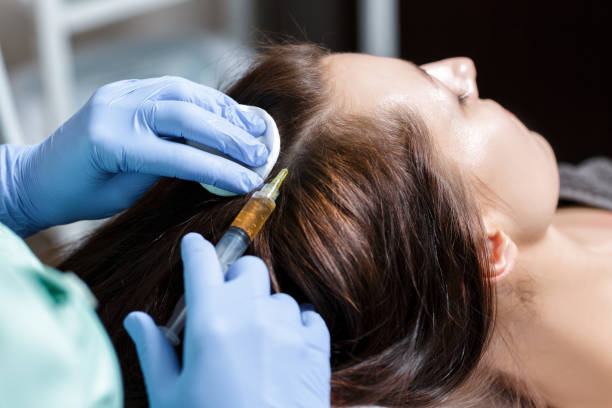 PRP Hair Treatment Breakthroughs: Emerging Trends in Hair Therapy