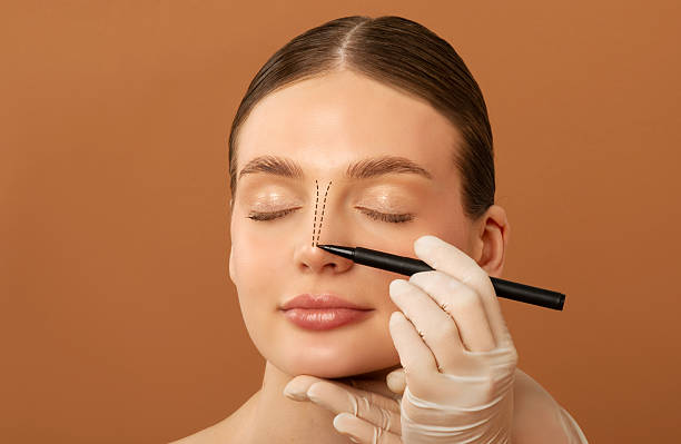 Rhinoplasty Expectations for Subtle Enhancements