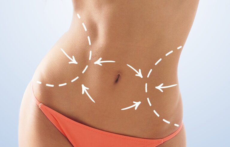 Is Liposuction Procedure Outpatient or Hospital-Based?