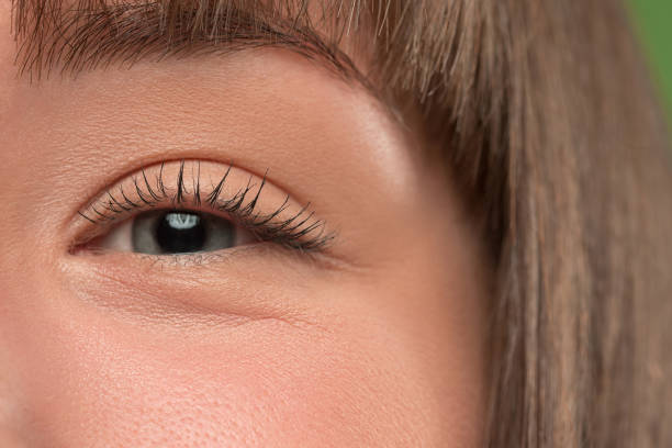 Mastering Eye Bag Removal: Complete Roadmap from Problem to Perfection