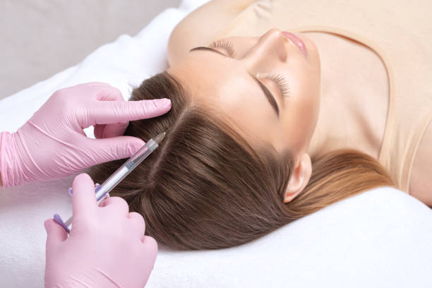 PRP Hair Treatment Home Care: Supporting Treatment Success